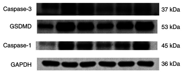 GSDMD Antibody - Figure 5.
