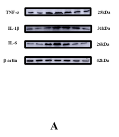 IL1 beta Antibody - Figure 9.