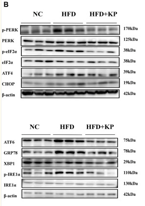 Phospho-IRE1 (Ser724) Antibody - FIGURE 2.