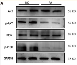 Phospho-AKT1/2/3 (Ser473) Antibody - Figure 6.