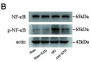 NF-kB p65 Antibody - Figure 5.