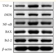 NF-kB p65 Antibody - Figure 4.