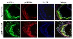 Phospho-IRE1 (Ser724) Antibody - Figure 4.