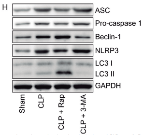 LC3A/B Antibody - Fig.
