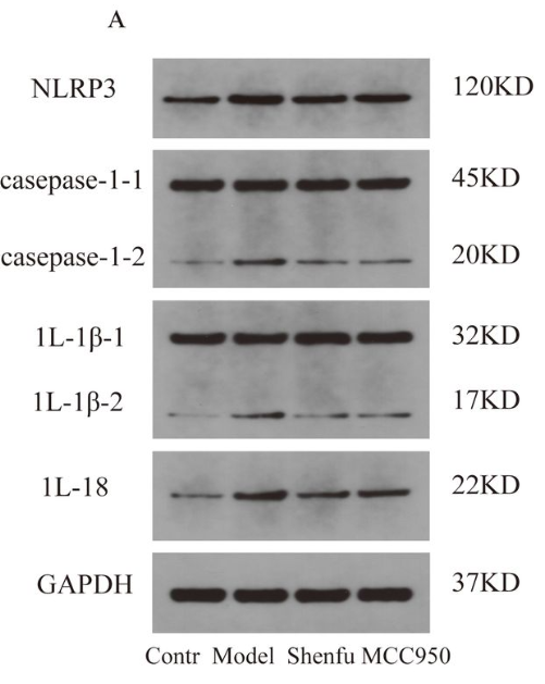 IL1 beta Antibody - Figure 4.