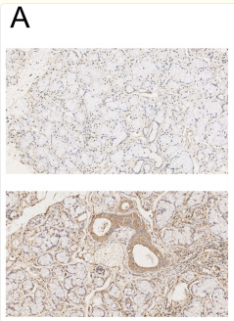 GSDMD Antibody - Figure 8.