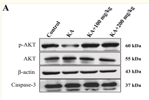 Phospho-AKT1/2/3 (Ser473) Antibody - Fig.