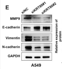MMP9 Antibody - Figure 5.