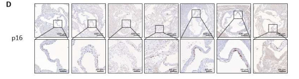 CDKN2A/p16INK4a Antibody - Fig.
