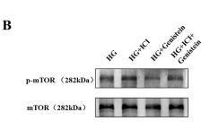 mTOR Antibody - Figure 1 Effect of Genistein on O-GlcNAcylation and HPMCs’ MMT alongside fibrosis induced by HG and HIF-1α.