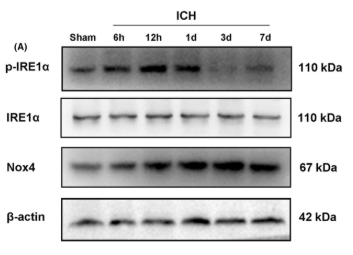 Phospho-IRE1 (Ser724) Antibody - FIGURE 2 The expression levels of p-IRE1α, IRE1α, Nox4, and miR-25-3p at different time points after ICH.