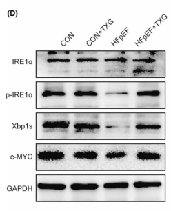 Phospho-IRE1 (Ser724) Antibody - FIGURE 5 TXG activates IRE1α/Xbp1s signalling pathway in HFpEF mice.