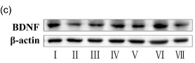 BDNF Antibody - FIGURE 8 Effects of repetitive transcranial magnetic stimulation (rTMS) with different high frequencies on BDNF protein in the substantia nigra and striatum.