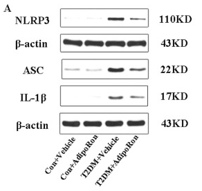 Cleaved-IL-1 beta (Asp116) Antibody - Fig.