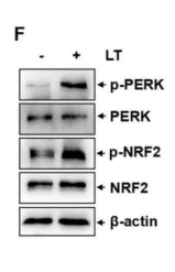Phospho-Nrf2 (Ser40) Antibody - Figure 4 PERK/NRF2 pathway activation was responsible for increased CX43 and StAR-dependent progesterone synthesis in the ovary of female mice under cold exposure.