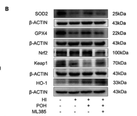 SOD2/MnSOD Antibody - Figure 5.
