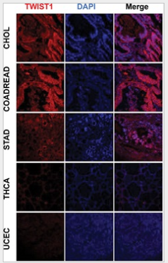 Twist1 Antibody - Figure 8.