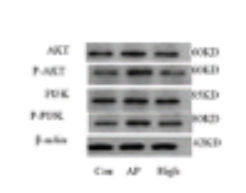 PI3K p85 alpha Antibody - Figure 10 WB plot of protein expression in rat pharyngeal tissue.