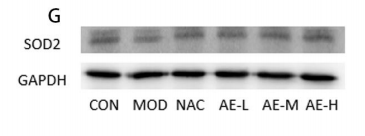 SOD2/MnSOD Antibody - Fig.