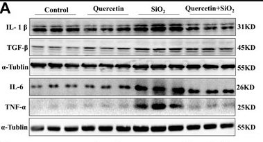 IL1 beta Antibody - FIGURE 7.