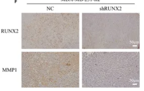 MMP1 Antibody - Figure 8 MMP1 and RUNX2 showed positively correlation in relative mRNA and protein expression.