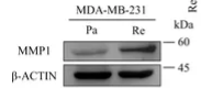 MMP1 Antibody - Figure 8 MMP1 and RUNX2 showed positively correlation in relative mRNA and protein expression.