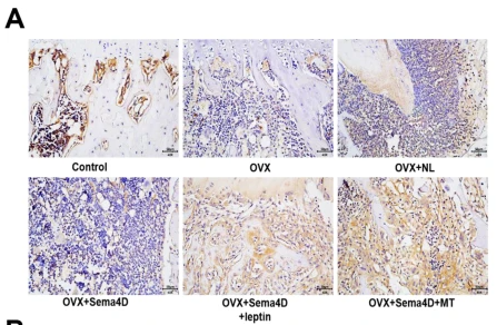BMP2 Antibody - Fig.
