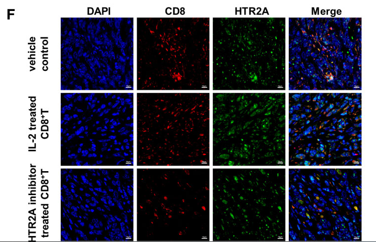 5HT2A Receptor Antibody - Figure 8 HTR2A inhibitor ketanserin suppresses the proliferation of CD8+T cells and promoted breast cancer metastasis.