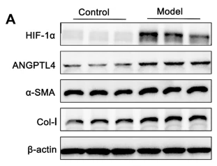 ANGPTL4 Antibody - Fig.