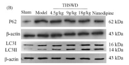 LC3B Antibody - Fig.