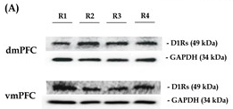 DRD1 Antibody - Figure 4D1R and D2R expression profiles in the mPFC in different rank groups.