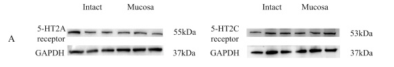 5HT2C Receptor Antibody - Fig.