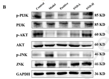 PI3K p85 alpha Antibody - Fig.