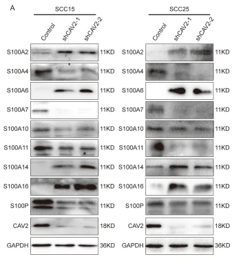 S100A16 Antibody - Fig.