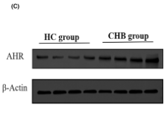 AhR Antibody - FIGURE 5 Validation of AhR gene expression in peripheral blood of CHB patients [median (interquartile range, IQR)].