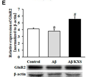GluR2/3 Antibody - FIGURE 3.