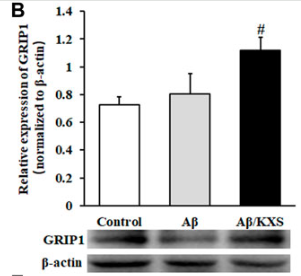 GRIP1 Antibody - FIGURE 4.