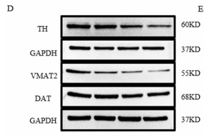 Tyrosine Hydroxylase Antibody - Fig.