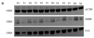 CCS/SOD4 Antibody - Figure 8 mRNA and protein relative expression of genes in the risk model.