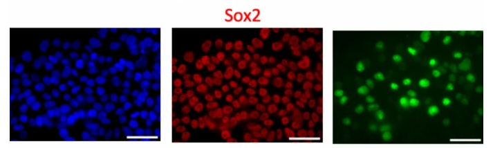 SOX2 Antibody - Fig.