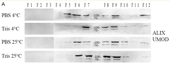 UMOD Antibody - Figure 1.
