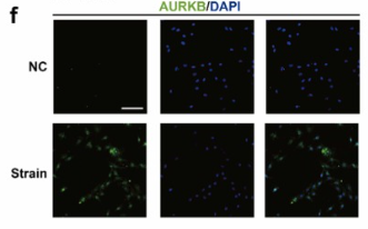 AurB Antibody - Fig.