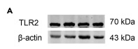 TLR2 Antibody - Figure 6 PKP2 is an upstream regulator of TLR2/TLR4/Nav1.