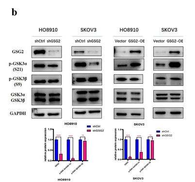 Phospho-GSK3 alpha (Ser21) Antibody - Fig.