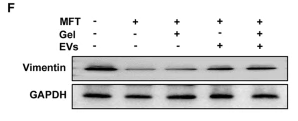 Vimentin mouse monoclonal Antibody - Fig.