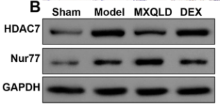 HDAC7 Antibody - Figure 4.