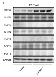 Glut 4 Antibody - Figure S15, Related to Figure 7.