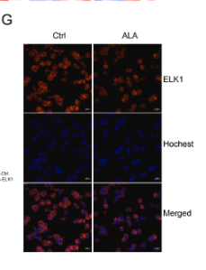 ELK1 Antibody - Fig.