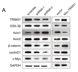 c-Myc Antibody - Figure 4 TRIM31 activates the Wnt/β-catenin pathway by enhancing Axin1 ubiquitination and degradation.