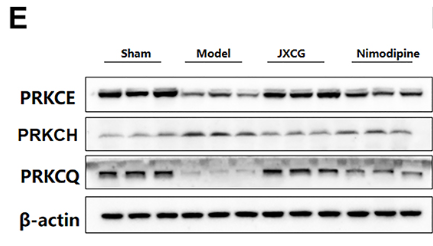 PKC theta Antibody - Figure 6 Results of the effect of Jiawei Xinglou Chengqi Granule (JXCG) on neural function in middle cerebral artery occlusion (MCAO) rats.